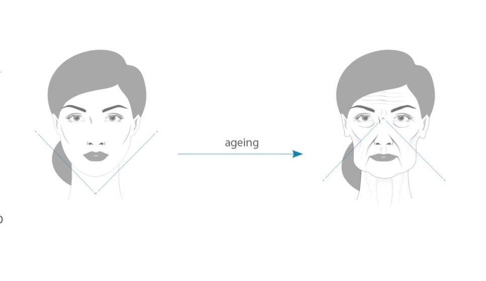 RADIESSE ageing aging Hyperdiluted Radiesse®+ (Radiesse®+ Wash)